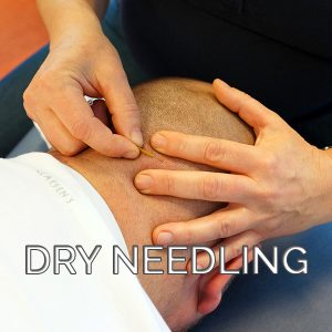 Specialisatie-Dry-Needling-300x300